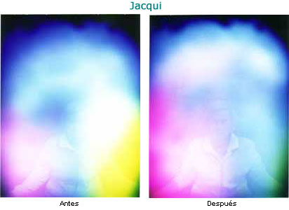 Jacqui antes y después.
