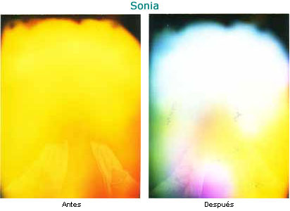 Sonia antes y después.
